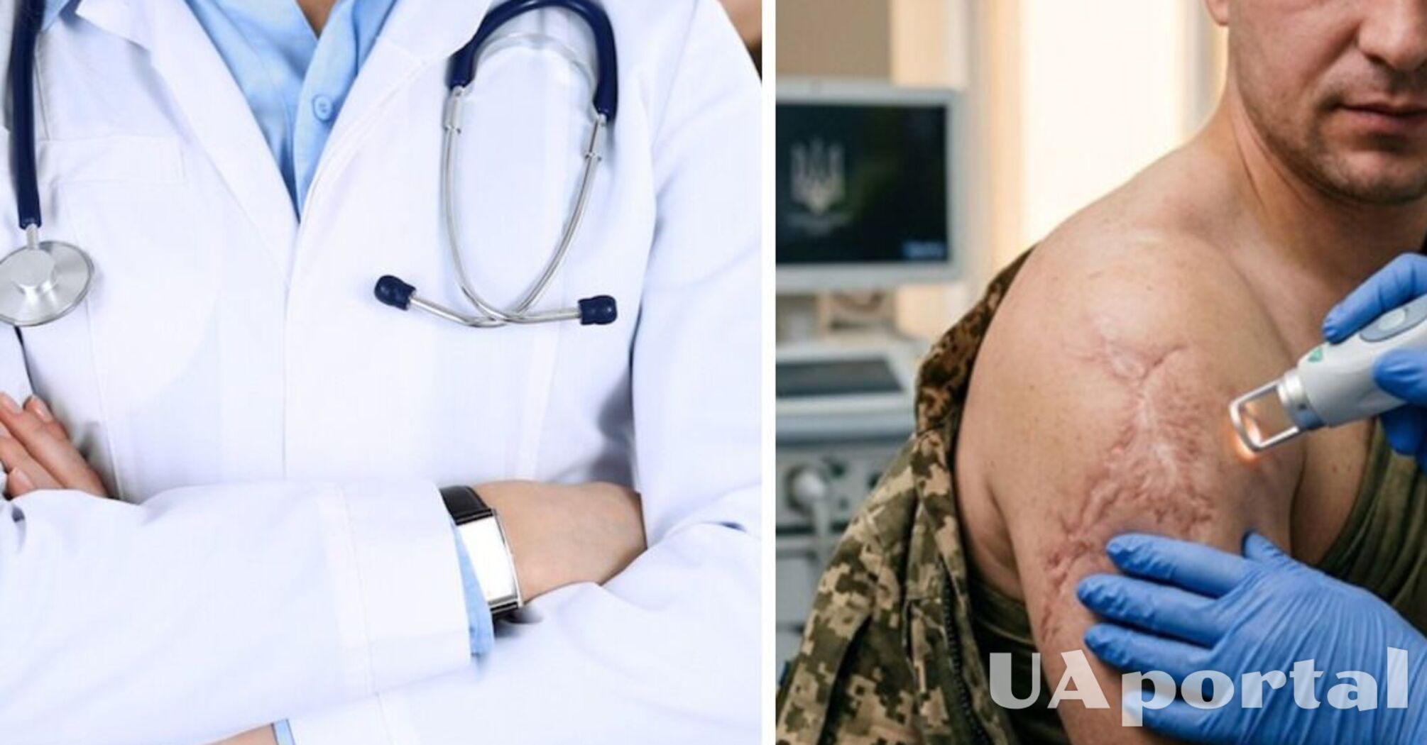 Хто з військових має право на безкоштовну лазерну корекцію рубців   