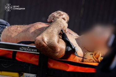 У Сумах авіаудар забрав життя однієї людини, ще 9 — травмовані